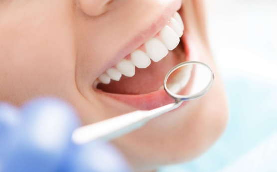 Qu'est-ce qu'un pansement pour les dents ? – Pharma expert